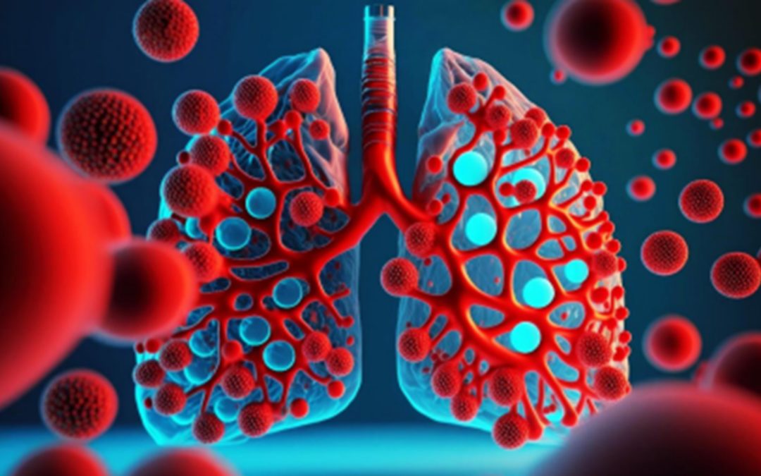 Making Early Detection The Priority In The Fight Against Lung Cancer