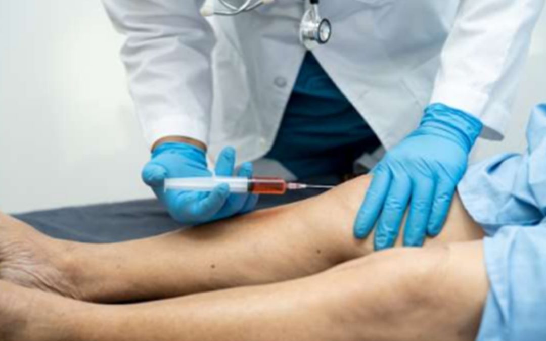 Chronic Venous Insufficiency: Don’t Dismiss It!