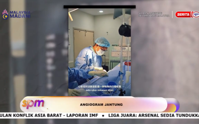 Sakit Dada dan Kesihatan Jantung: Mengapa Angiogram Penting